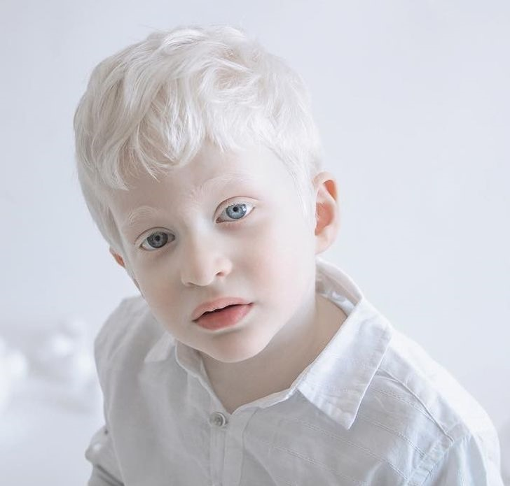 A child with white hair

Description automatically generated