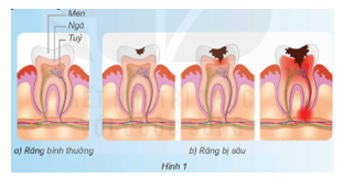 BÀI 20: VI KHUẨN GÂY BỆNH Ở NGƯỜI VÀ CÁCH PHÒNG TRÁNH(2 tiết)