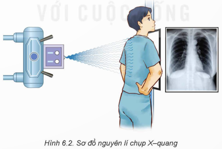 BÀI 6: CHỤP X – QUANG. CHỤP CẮT LỚP 