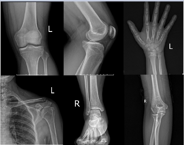 CHUYÊN ĐỀ 2: MỘT SỐ ỨNG DỤNG VẬT LÍ TRONG CHẨN ĐOÁN Y HỌC