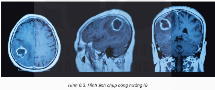 BÀI 8: CHỤP CỘNG HƯỞNG TỪ