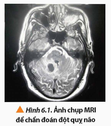 BÀI 6: CHỤP ẢNH CỘNG HƯỞNG TỪ (MRI)