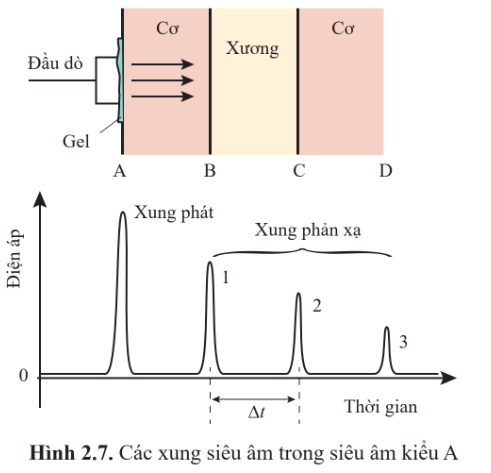 BÀI 2: SIÊU ÂM VÀ CỘNG HƯỞNG TỪ