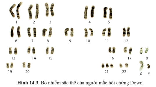 BÀI 14: DI TRUYỀN HỌC NGƯỜI