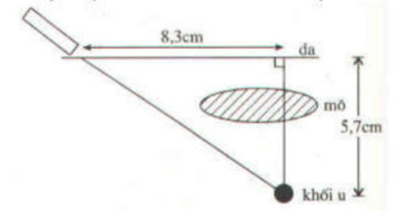 BÀI 3:ỨNG DỤNG CỦA TỈ SỐ LƯỢNG GIÁC CỦA GÓC NHỌN