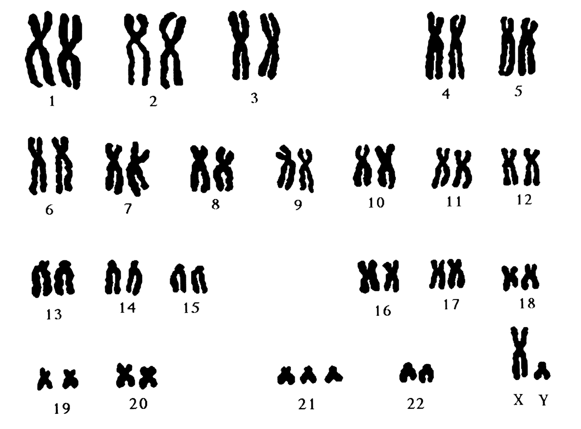 BÀI 14: DI TRUYỀN HỌC NGƯỜI (14 câu)