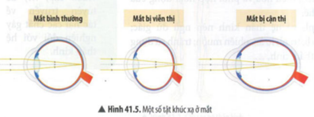 BÀI 41: HỆ THẦN KINH VÀ CÁC GIÁC QUAN Ở NGƯỜI