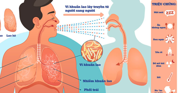 BÀI 37: HỆ HÔ HẤP Ở NGƯỜI