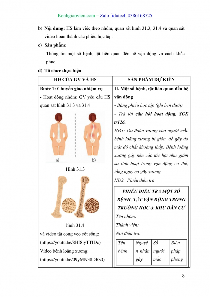 Giáo án và PPT KHTN 8 kết nối Bài 31: Hệ vận động ở người