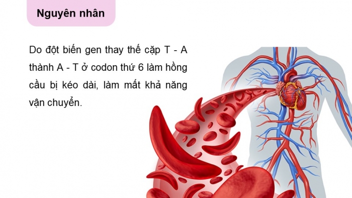 Giáo án điện tử Sinh học 12 cánh diều Bài 4: Đột biến gene