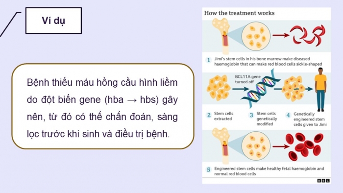 Giáo án điện tử Sinh học 12 kết nối Bài 13: Di truyền học người và di truyền y học