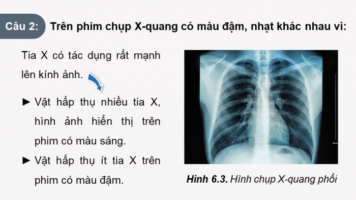 Giáo án điện tử chuyên đề Vật lí 12 kết nối Bài 6: Chụp X-quang. Chụp cắt lớp