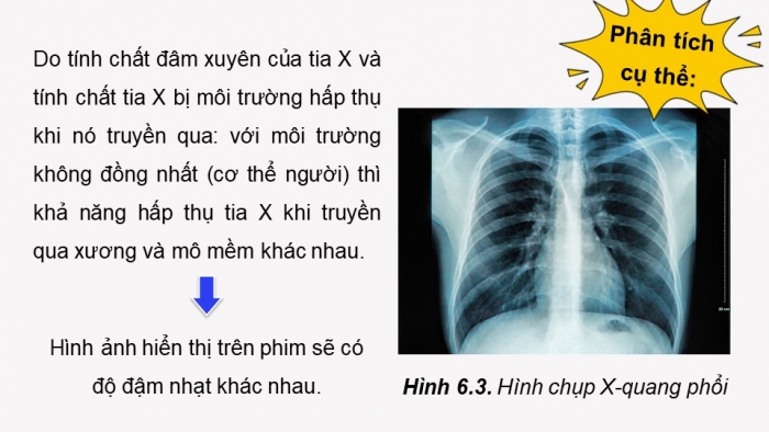 Giáo án điện tử chuyên đề Vật lí 12 kết nối Bài 6: Chụp X-quang. Chụp cắt lớp