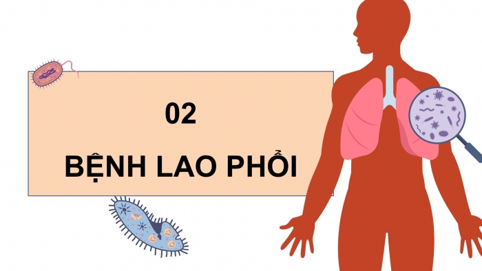 Giáo án điện tử Khoa học 5 chân trời Bài 20: Một số bệnh ở người do vi khuẩn gây ra