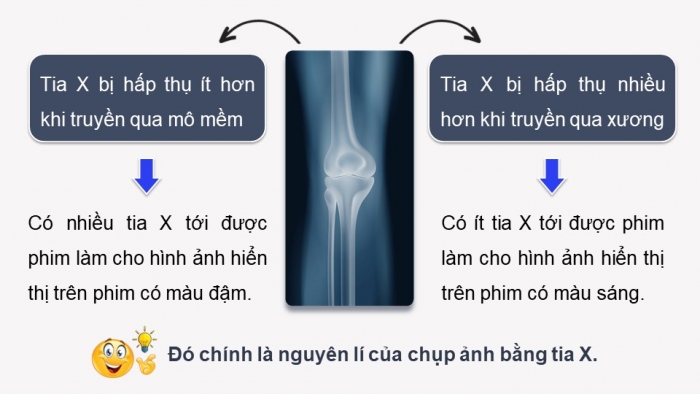 Giáo án điện tử chuyên đề Vật lí 12 kết nối Bài 6: Chụp X-quang. Chụp cắt lớp