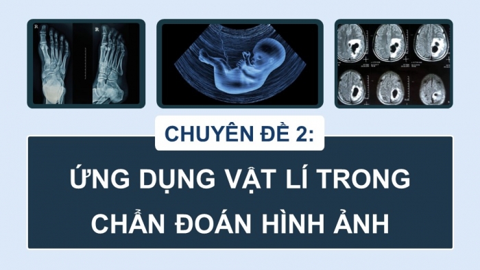 Giáo án điện tử chuyên đề Vật lí 12 cánh diều Bài 1: Tia X và tạo ảnh bằng tia X