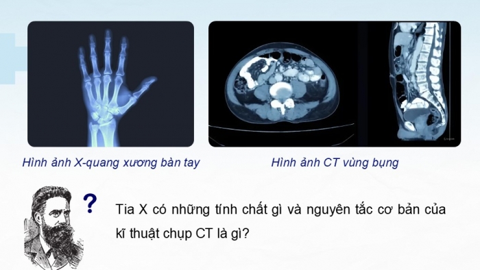 Giáo án điện tử chuyên đề Vật lí 12 chân trời Bài 5: Tia X. Chụp ảnh X-quang và chụp ảnh cắt lớp (CT)