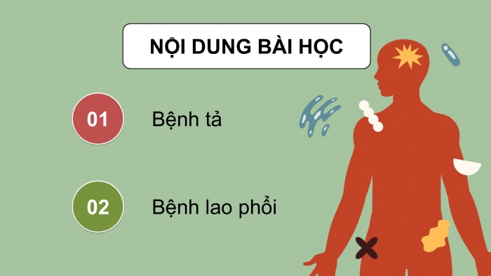 Giáo án điện tử Khoa học 5 chân trời Bài 20: Một số bệnh ở người do vi khuẩn gây ra