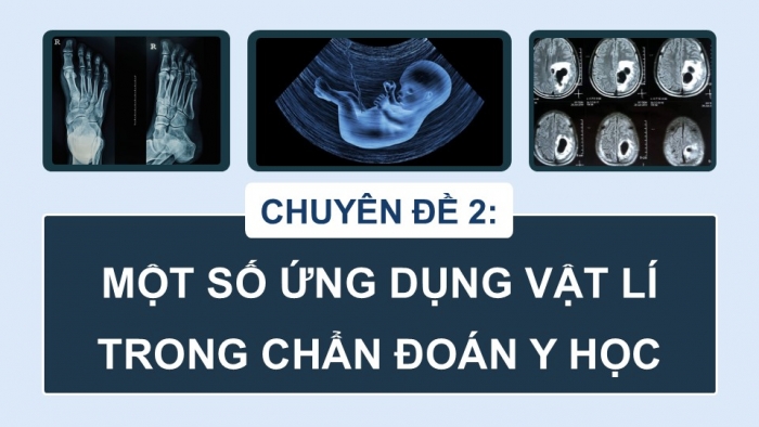 Giáo án điện tử chuyên đề Vật lí 12 kết nối Bài 5: Tia X