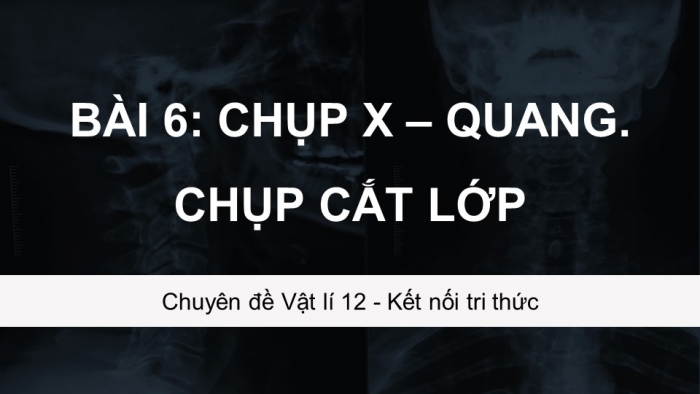 Giáo án điện tử chuyên đề Vật lí 12 kết nối Bài 6: Chụp X-quang. Chụp cắt lớp