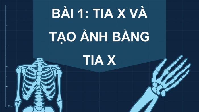 Giáo án điện tử chuyên đề Vật lí 12 cánh diều Bài 1: Tia X và tạo ảnh bằng tia X