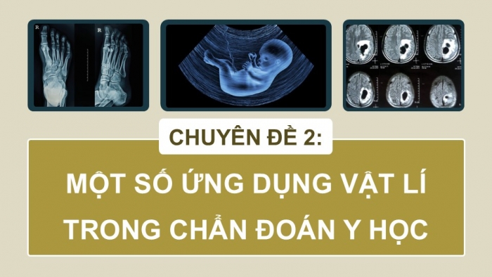 Giáo án điện tử chuyên đề Vật lí 12 chân trời Bài 4: Chẩn đoán bằng siêu âm