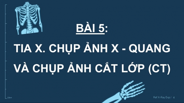 Giáo án điện tử chuyên đề Vật lí 12 chân trời Bài 5: Tia X. Chụp ảnh X-quang và chụp ảnh cắt lớp (CT)