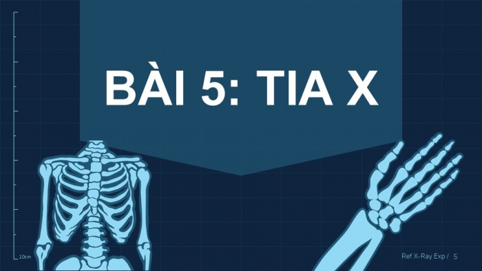 Giáo án điện tử chuyên đề Vật lí 12 kết nối Bài 5: Tia X