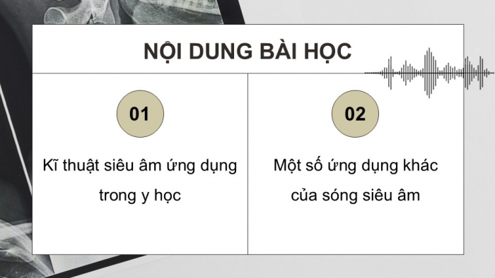 Giáo án điện tử chuyên đề Vật lí 12 chân trời Bài 4: Chẩn đoán bằng siêu âm