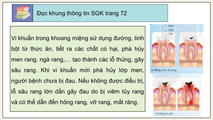 Giáo án điện tử Khoa học 5 kết nối Bài 20: Vi khuẩn gây bệnh ở người và cách phòng tránh