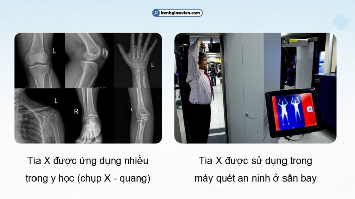 Giáo án điện tử chuyên đề Vật lí 12 chân trời Bài 5: Tia X. Chụp ảnh X-quang và chụp ảnh cắt lớp (CT)