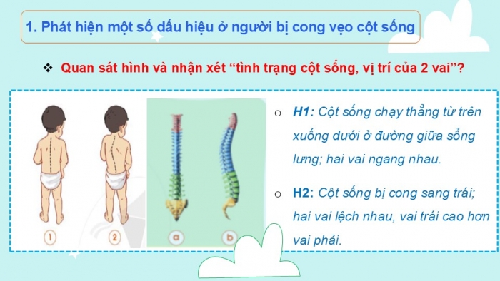 Giáo án PPT Tự nhiên và Xã hội 2 cánh diều Bài 15: Phòng tránh cong vẹo cột sống