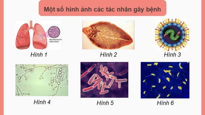 Giáo án điện tử chuyên đề Sinh học 11 chân trời Bài 6: Một số bệnh dịch phổ biến ở người