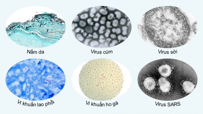 Giáo án điện tử chuyên đề Sinh học 11 cánh diều Bài 5: Nguyên nhân lây nhiễm bệnh dịch ở người