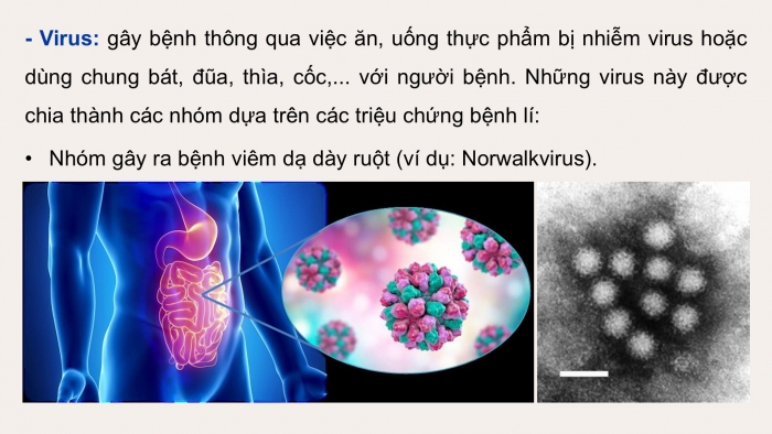 Giáo án điện tử chuyên đề Sinh học 11 kết nối Bài 10: Ngộ độc thực phẩm