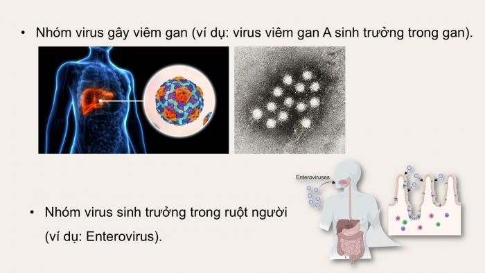 Giáo án điện tử chuyên đề Sinh học 11 kết nối Bài 10: Ngộ độc thực phẩm