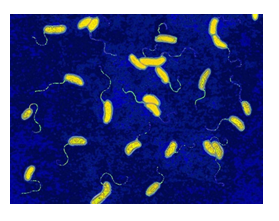 Trắc nghiệm bài 25: Vi khuẩn