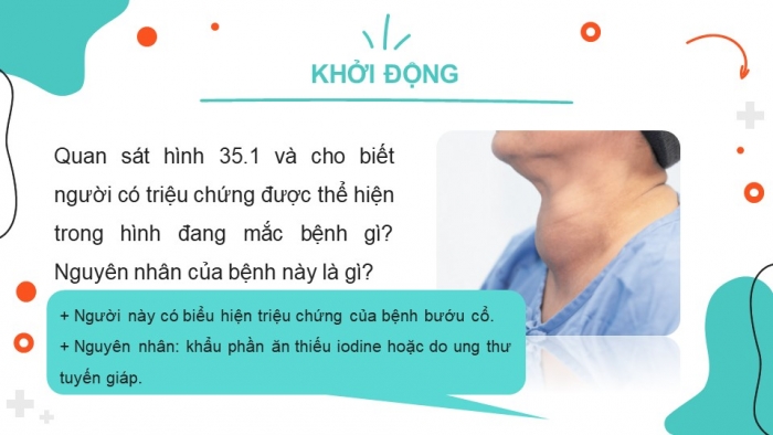 Giáo án điện tử KHTN 8 cánh diều Bài 35: Hệ nội tiết ở người